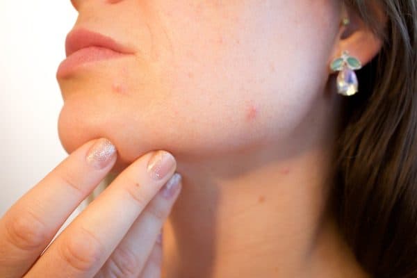 Naturlig hudpleie: Produkter og metoder